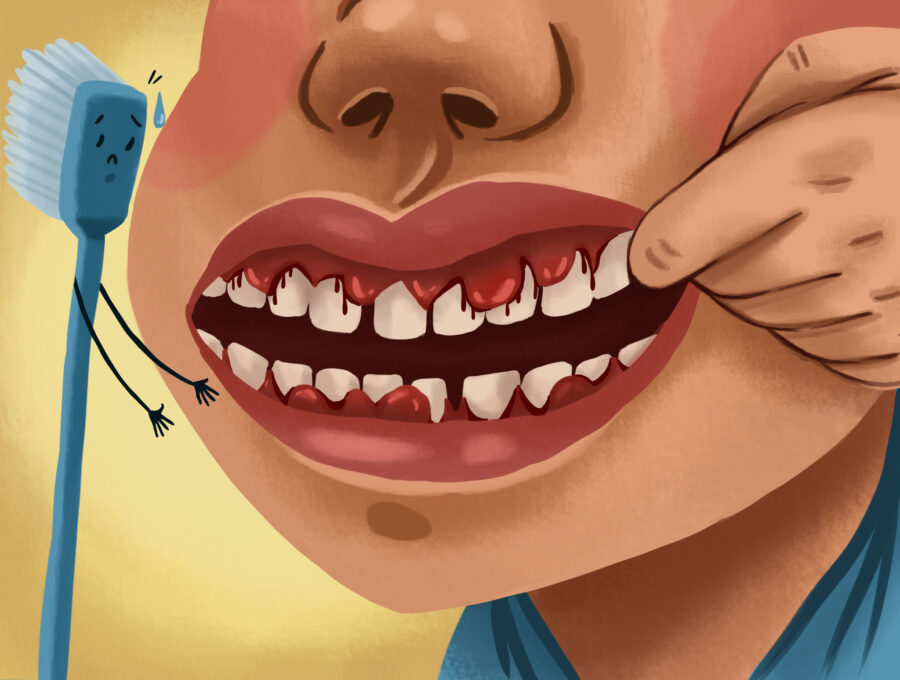 Suffering From Gingivitis? Dr. Memar Explains Common Causes & Treatments